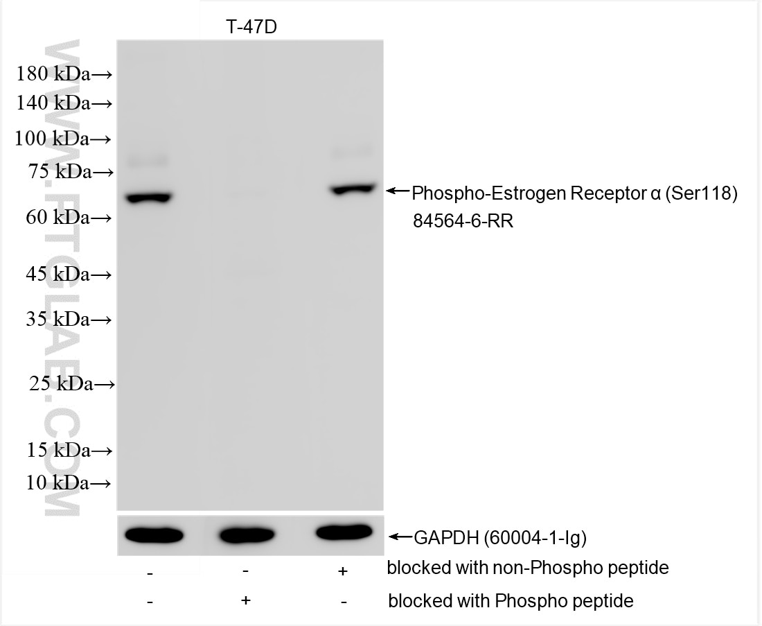 Western Blot (WB) analysis of various lysates using Phospho-Estrogen Receptor α (Ser118) Recombinant a (84564-6-RR)