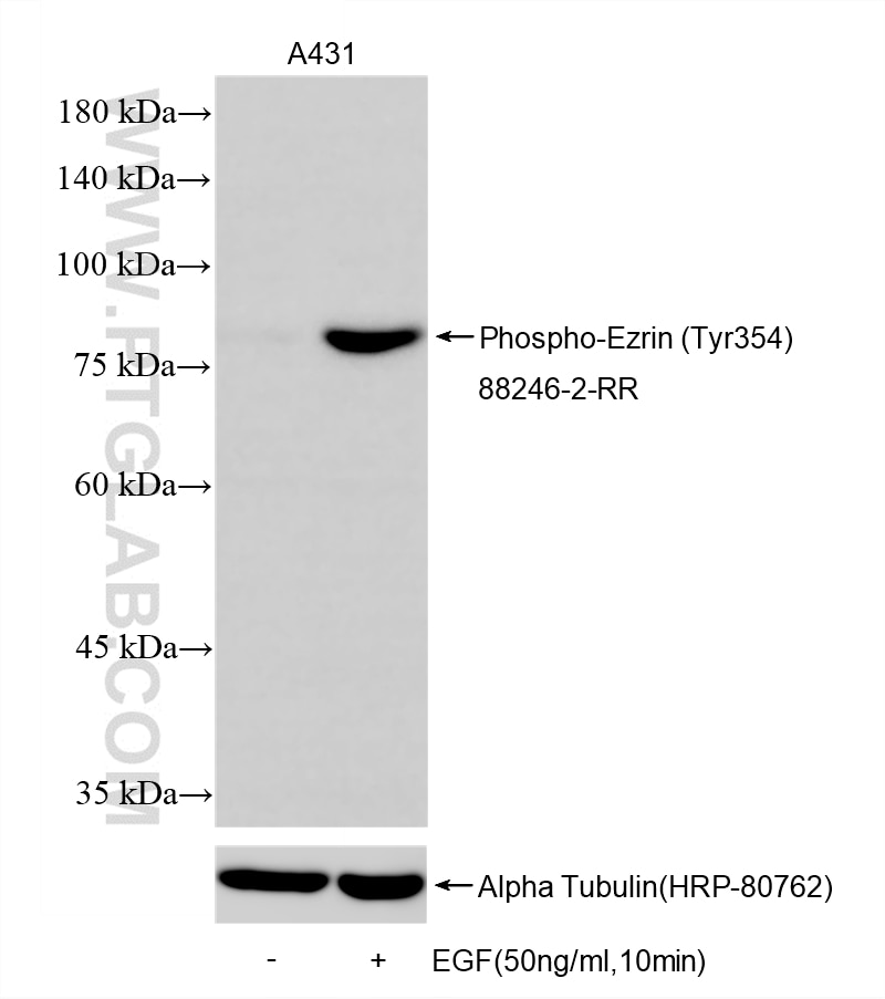 WB analysis using 88246-2-RR Western Blot (WB) analysis of various lysates using Phospho-Ezrin (Tyr354) Recombinant monoclonal anti (88246-2-RR)