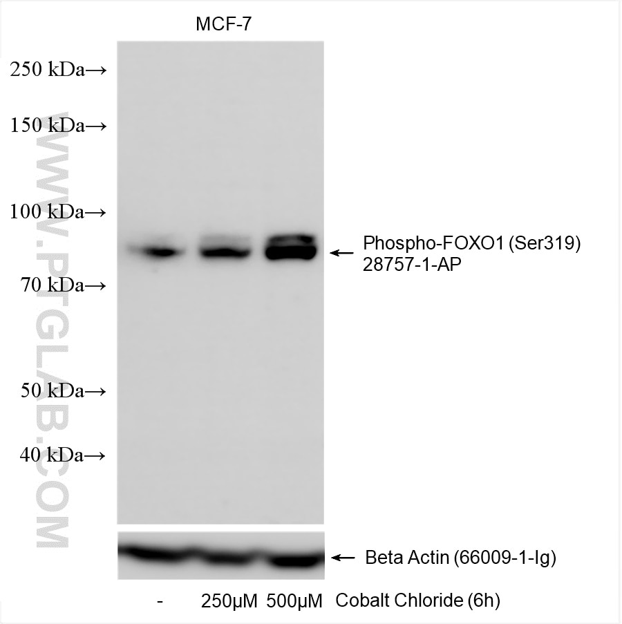 Western Blot (WB) analysis of various lysates using Phospho-FOXO1 (Ser319) Polyclonal antibody (28757-1-AP)