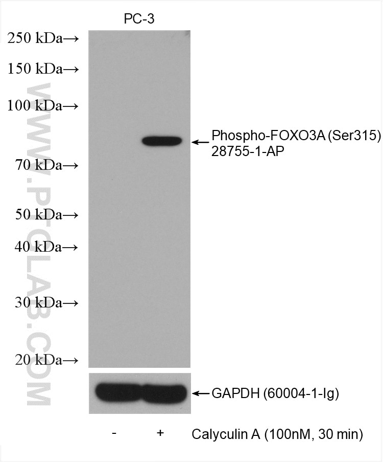 Western Blot (WB) analysis of various lysates using Phospho-FOXO3A (Ser315) Polyclonal antibody (28755-1-AP)