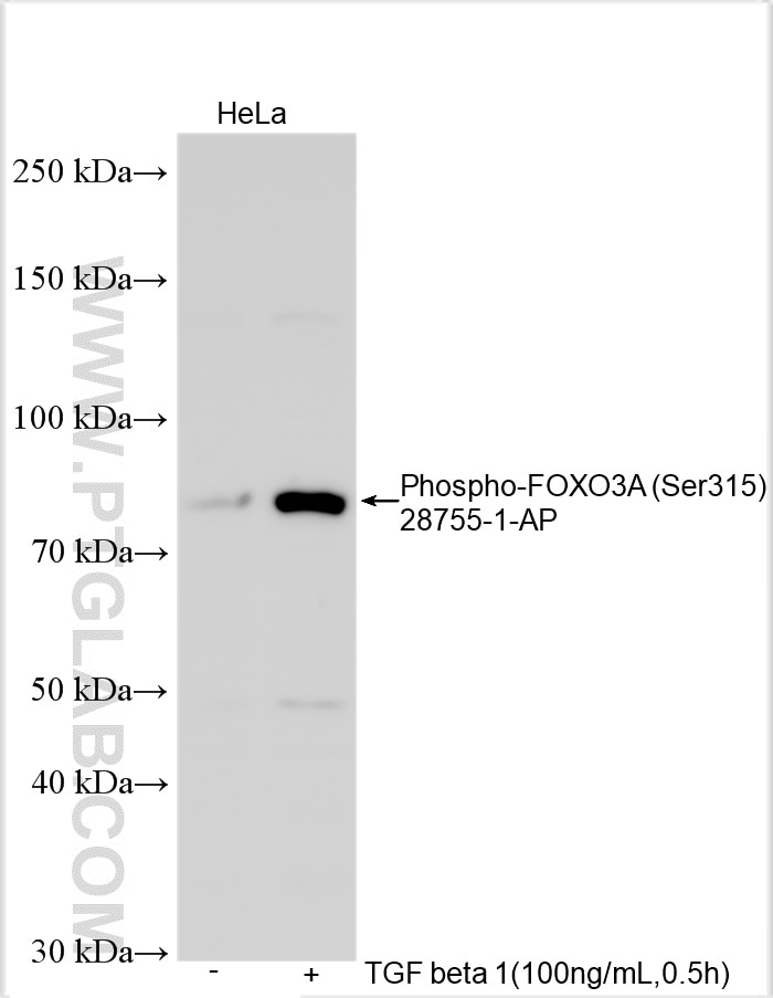 Western Blot (WB) analysis of various lysates using Phospho-FOXO3A (Ser315) Polyclonal antibody (28755-1-AP)