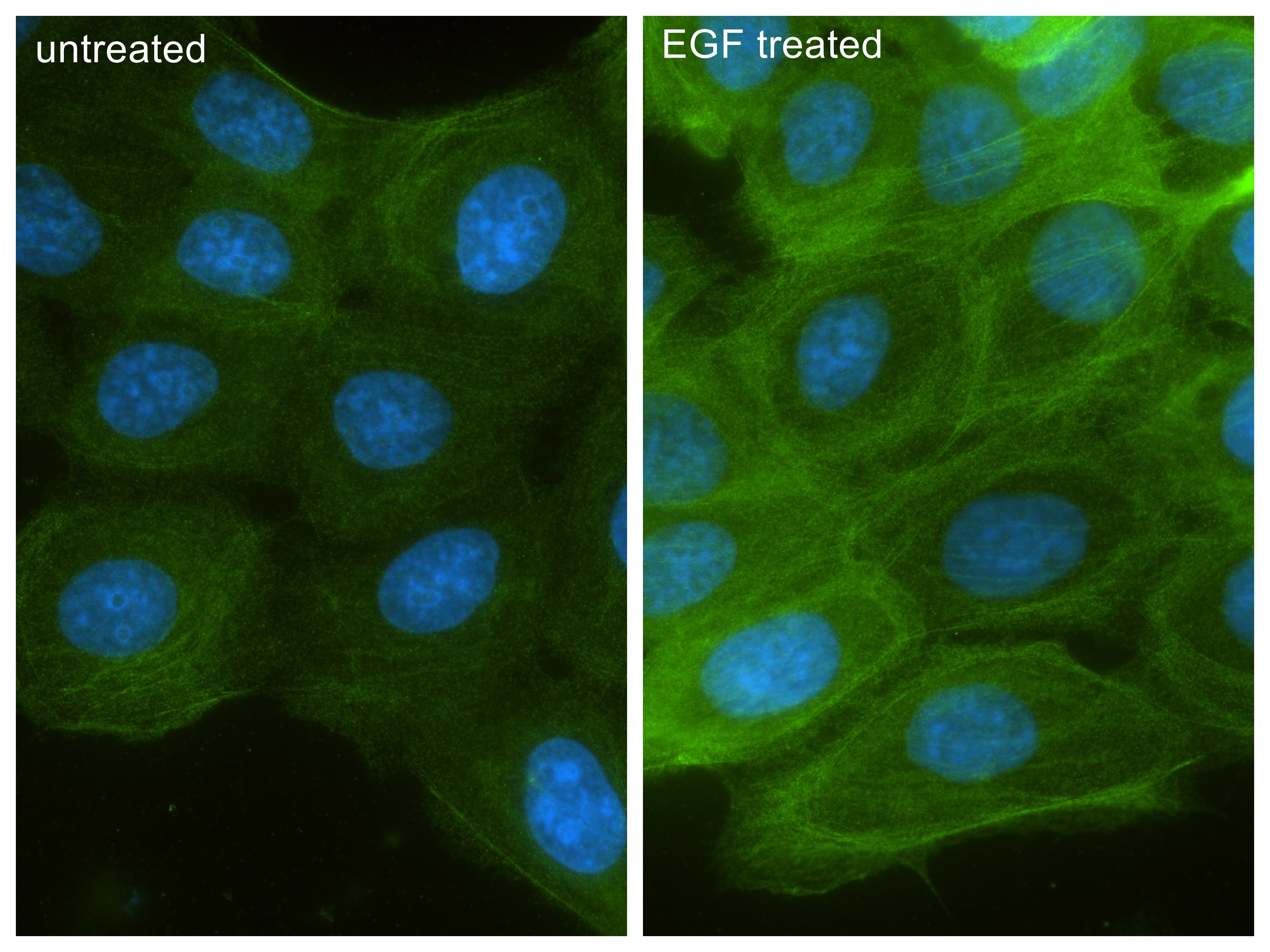 IF Staining of A431 using 87513-1-RR (same clone as 87513-1-PBS) Immunofluorescence (IF) / fluorescent staining of A431 cells using Phospho-Filamin A (Ser2152) Recombinant monoclonal (87513-1-RR)