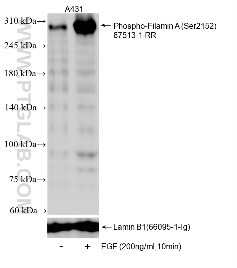 Western Blot (WB) analysis of A431 cells using Phospho-Filamin A (Ser2152) Recombinant monoclonal (87513-1-RR)
