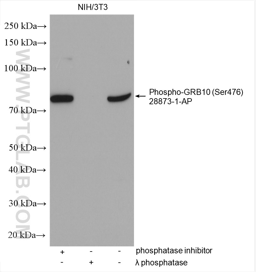 Western Blot (WB) analysis of various lysates using Phospho-GRB10 (Ser476) Polyclonal antibody (28873-1-AP)