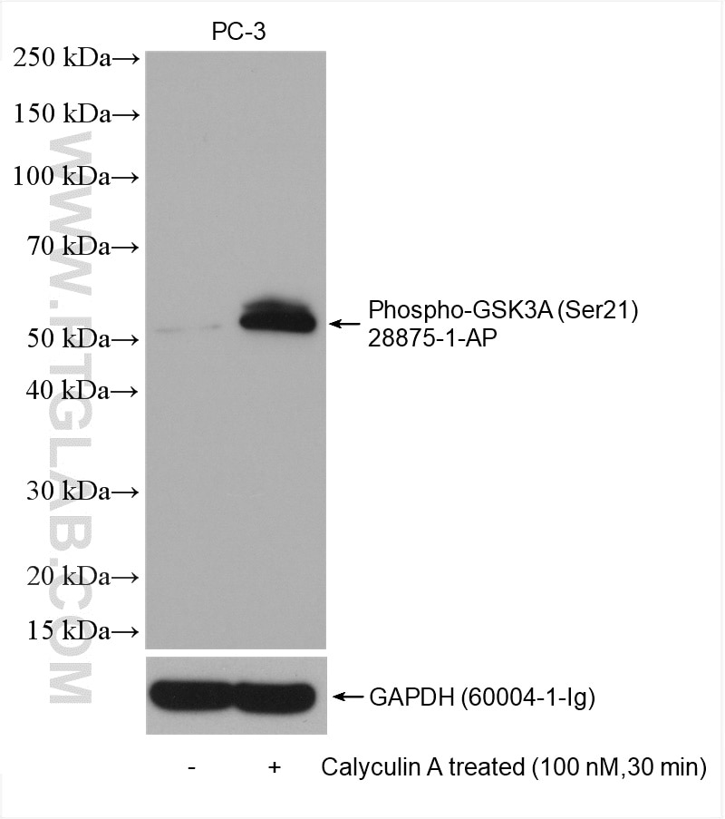 Western Blot (WB) analysis of various lysates using Phospho-GSK3A (Ser21) Polyclonal antibody (28875-1-AP)