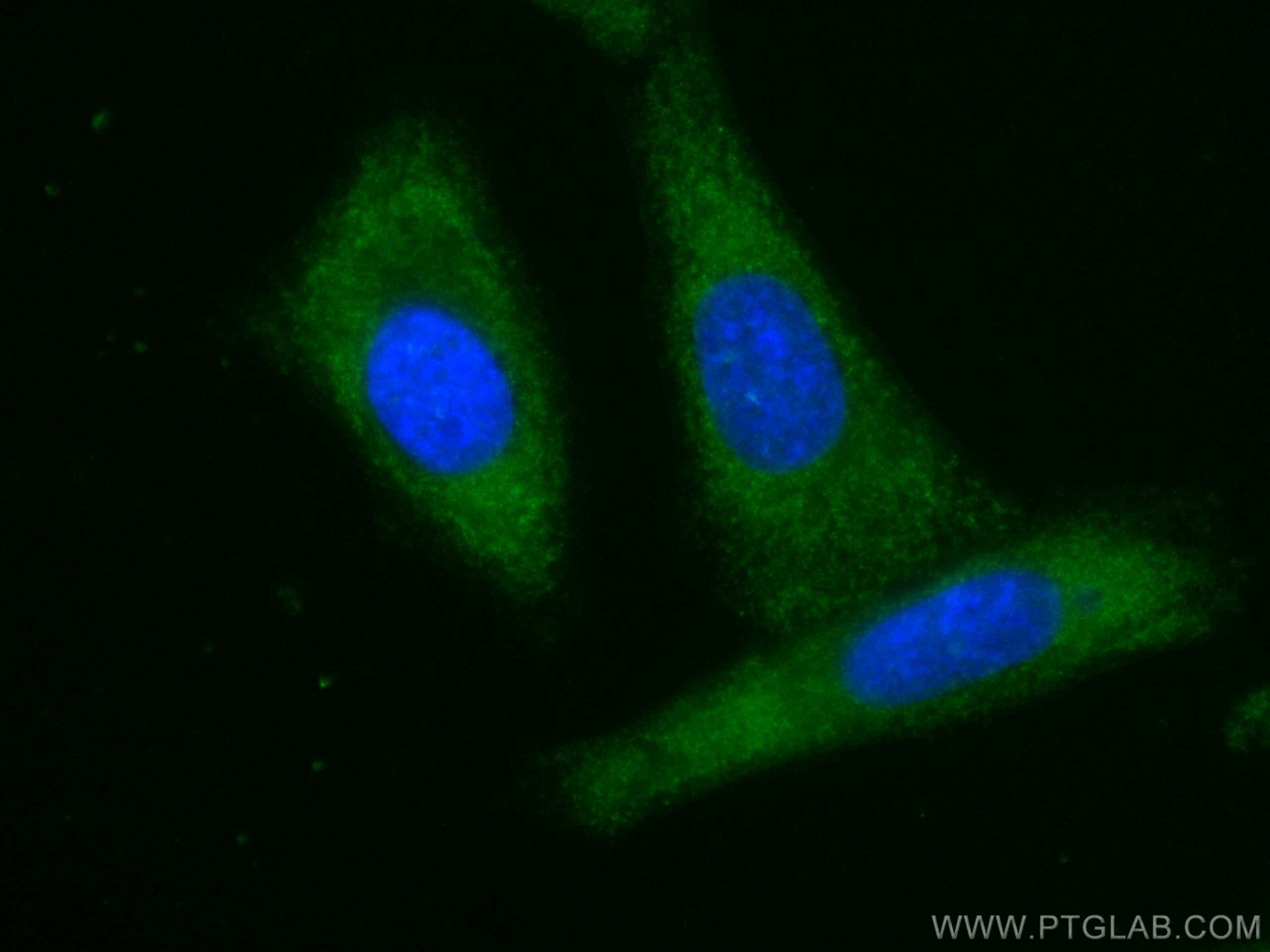 Phospho-GSK3B (Ser9)