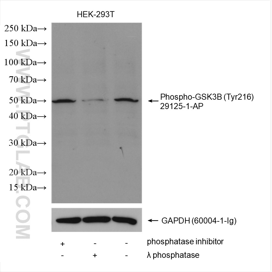 Western Blot (WB) analysis of various lysates using Phospho-GSK3B (Tyr216) Polyclonal antibody (29125-1-AP)