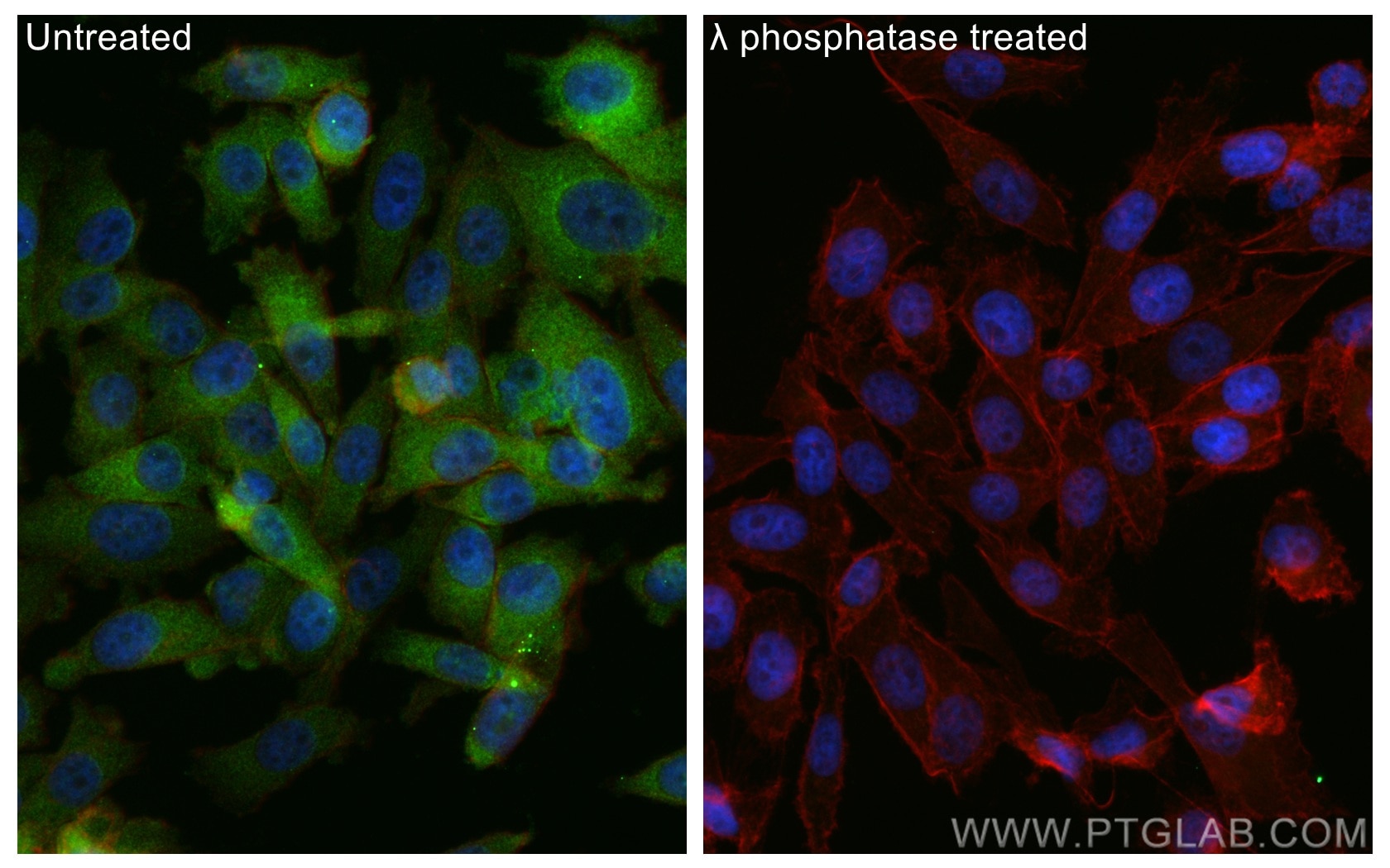 Immunofluorescence (IF) / fluorescent staining of PC-3 cells using Phospho-GYS1 (Ser641) Polyclonal antibody (28855-1-AP)