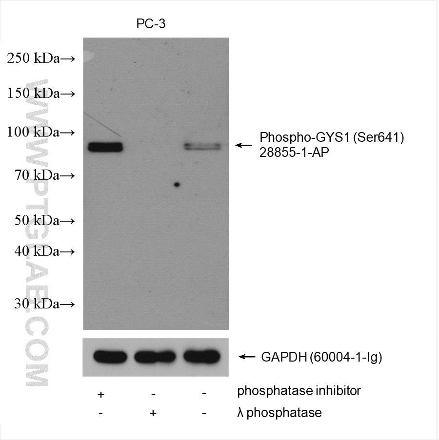 Western Blot (WB) analysis of various lysates using Phospho-GYS1 (Ser641) Polyclonal antibody (28855-1-AP)