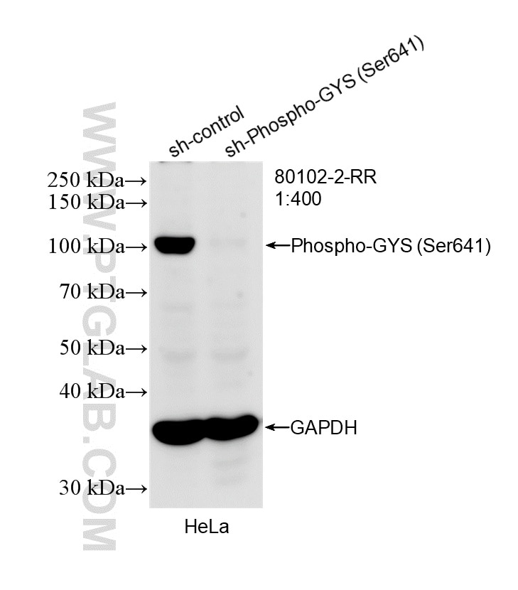 Western Blot (WB) analysis of HeLa cells using Phospho-GYS (Ser641) Recombinant monoclonal antibo (80102-2-RR)