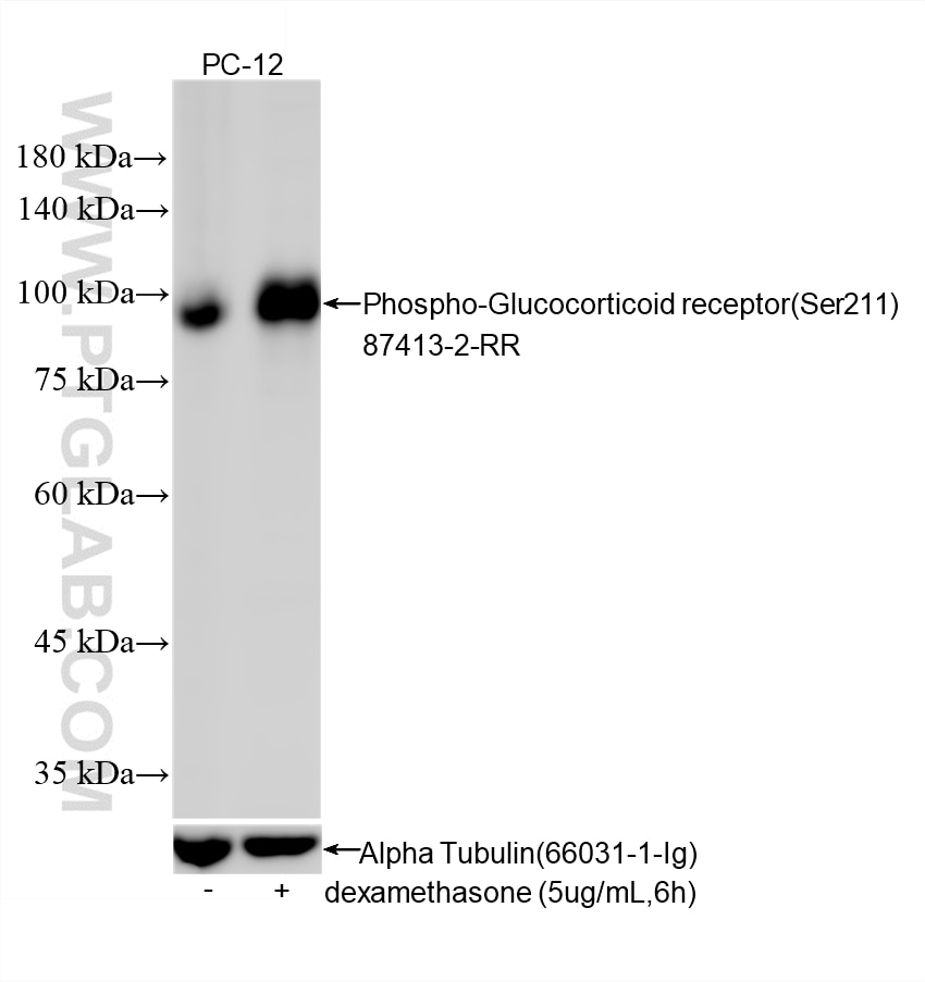 Western Blot (WB) analysis of various lysates using Phospho-Glucocorticoid receptor (Ser211) Recombina (87413-2-RR)