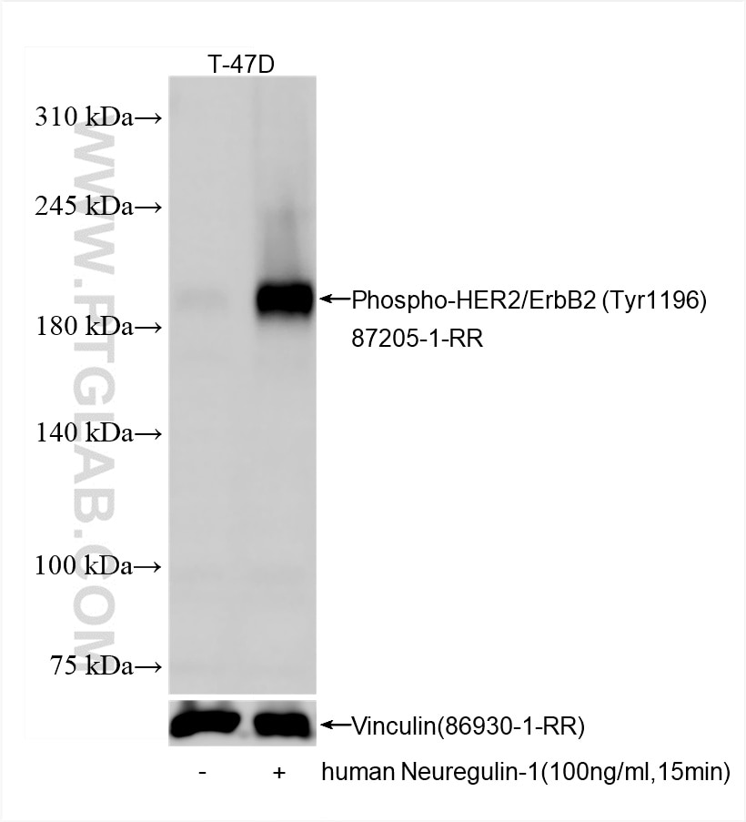 WB analysis of T-47D using 87205-1-RR Western Blot (WB) analysis of T-47D cells using Phospho-HER2/ErbB2 (Tyr1196) Recombinant monoclona (87205-1-RR)