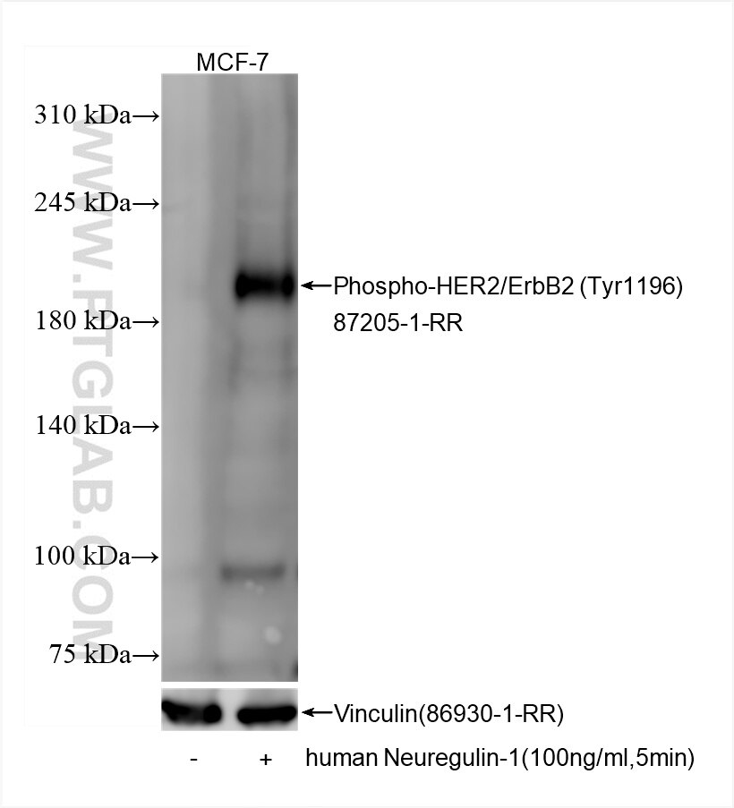 WB analysis using 87205-1-RR Western Blot (WB) analysis of various lysates using Phospho-HER2/ErbB2 (Tyr1196) Recombinant monoclona (87205-1-RR)
