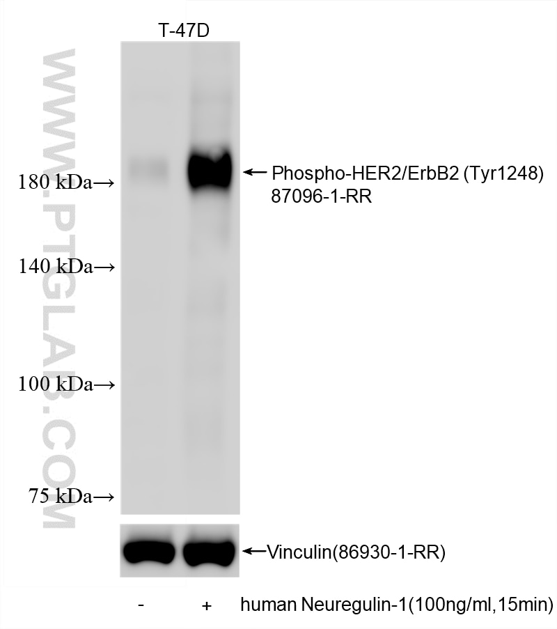Western Blot (WB) analysis of various lysates using Phospho-HER2/ErbB2 (Tyr1248) Recombinant monoclona (87096-1-RR)