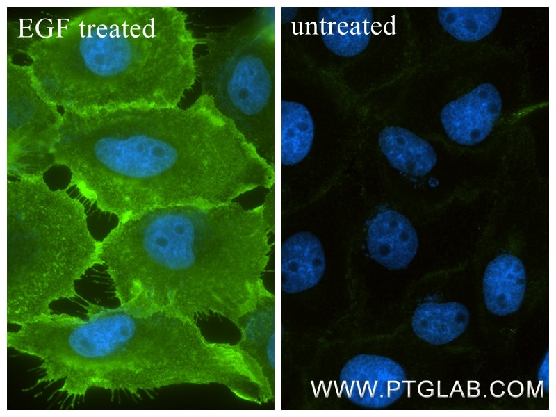 Immunofluorescence (IF) / fluorescent staining of A431 cells using Phospho-HER2/ErbB2 (Tyr877) Recombinant monoclonal (82762-11-RR)