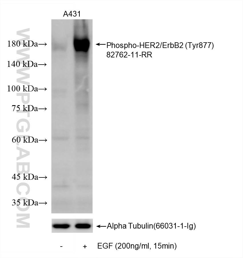 Western Blot (WB) analysis of various lysates using Phospho-HER2/ErbB2 (Tyr877) Recombinant antibody (82762-11-RR)
