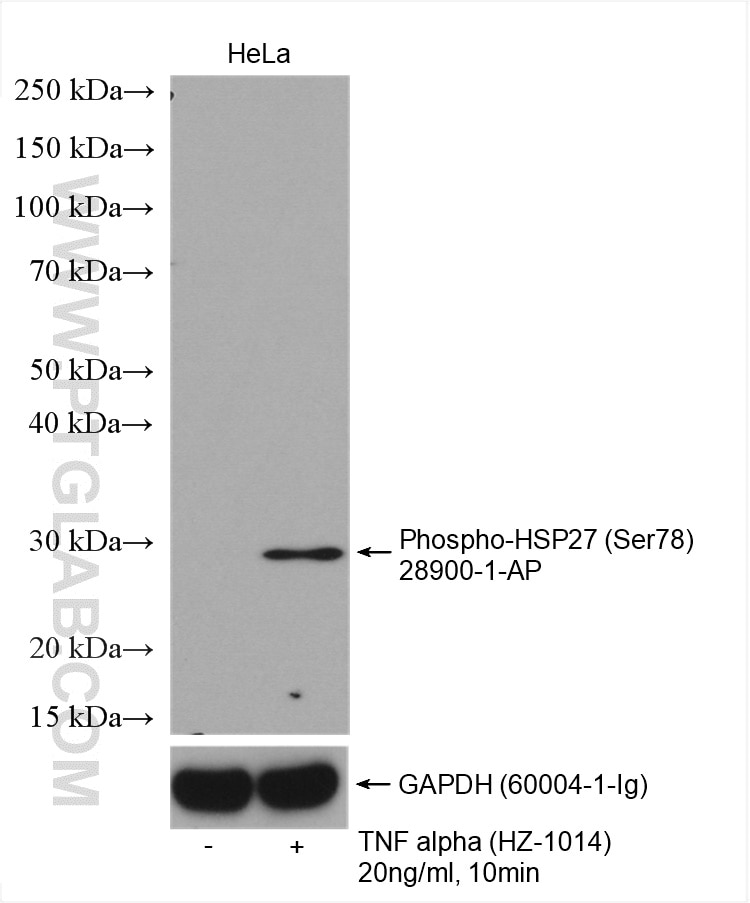 Western Blot (WB) analysis of various lysates using Phospho-HSP27 (Ser78) Polyclonal antibody (28900-1-AP)