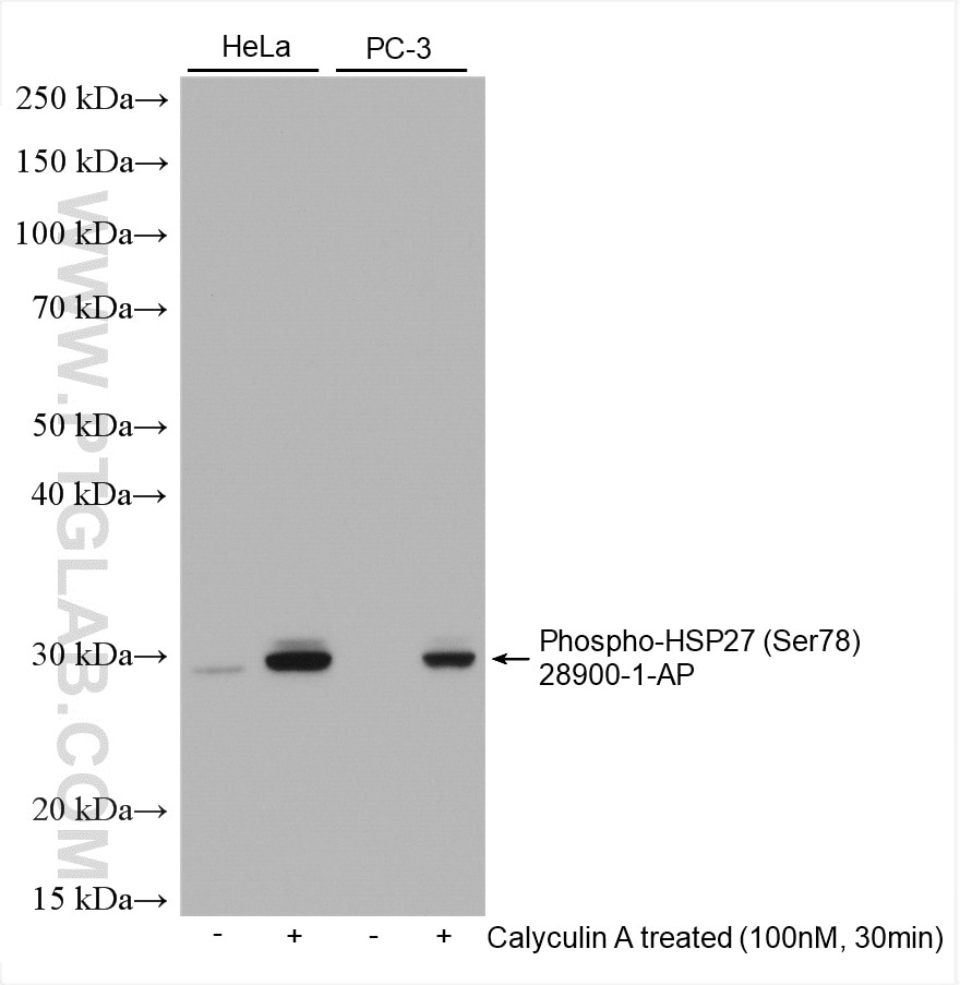 Western Blot (WB) analysis of various lysates using Phospho-HSP27 (Ser78) Polyclonal antibody (28900-1-AP)