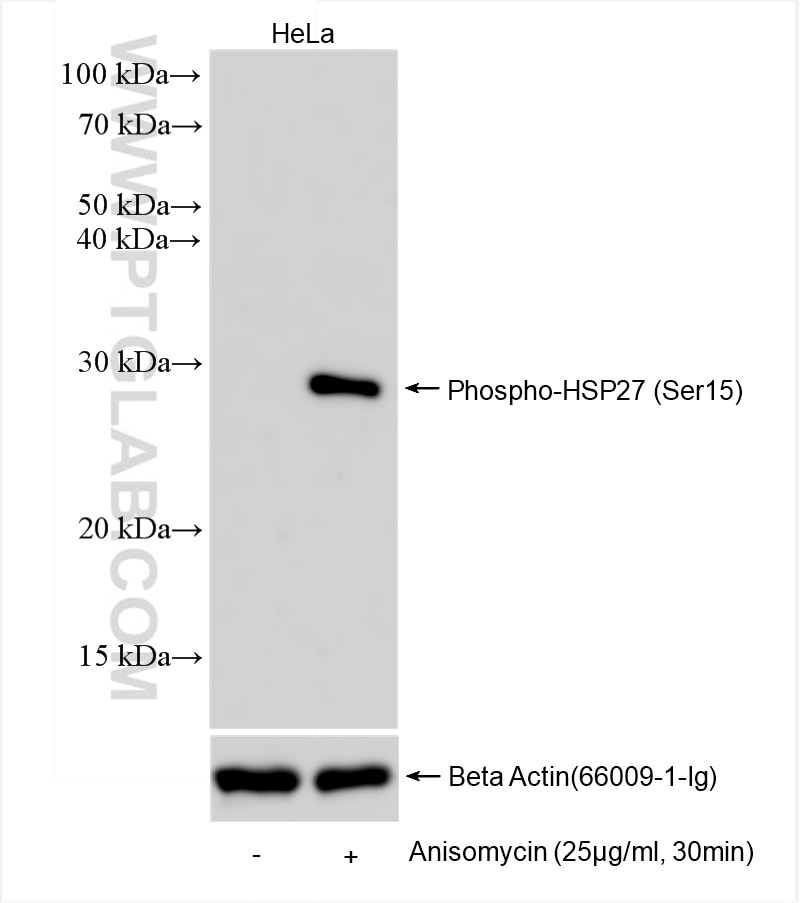 Phospho-HSP27 (Ser15)