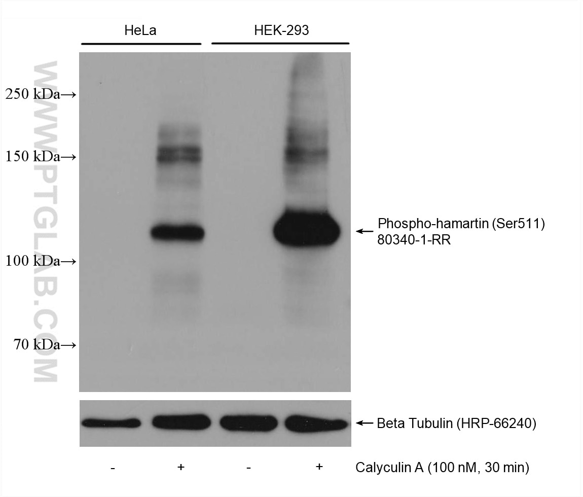 Western Blot (WB) analysis of various lysates using Phospho-Hamartin/TSC1 (Ser511) Recombinant antibod (80340-1-RR)