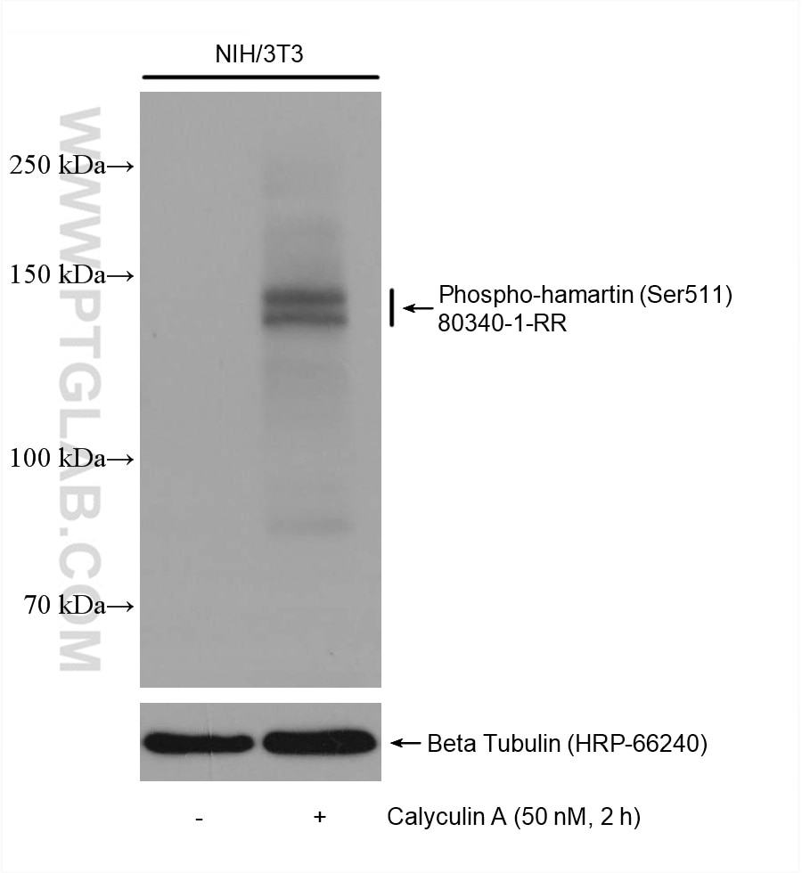 Western Blot (WB) analysis of various lysates using Phospho-Hamartin/TSC1 (Ser511) Recombinant antibod (80340-1-RR)