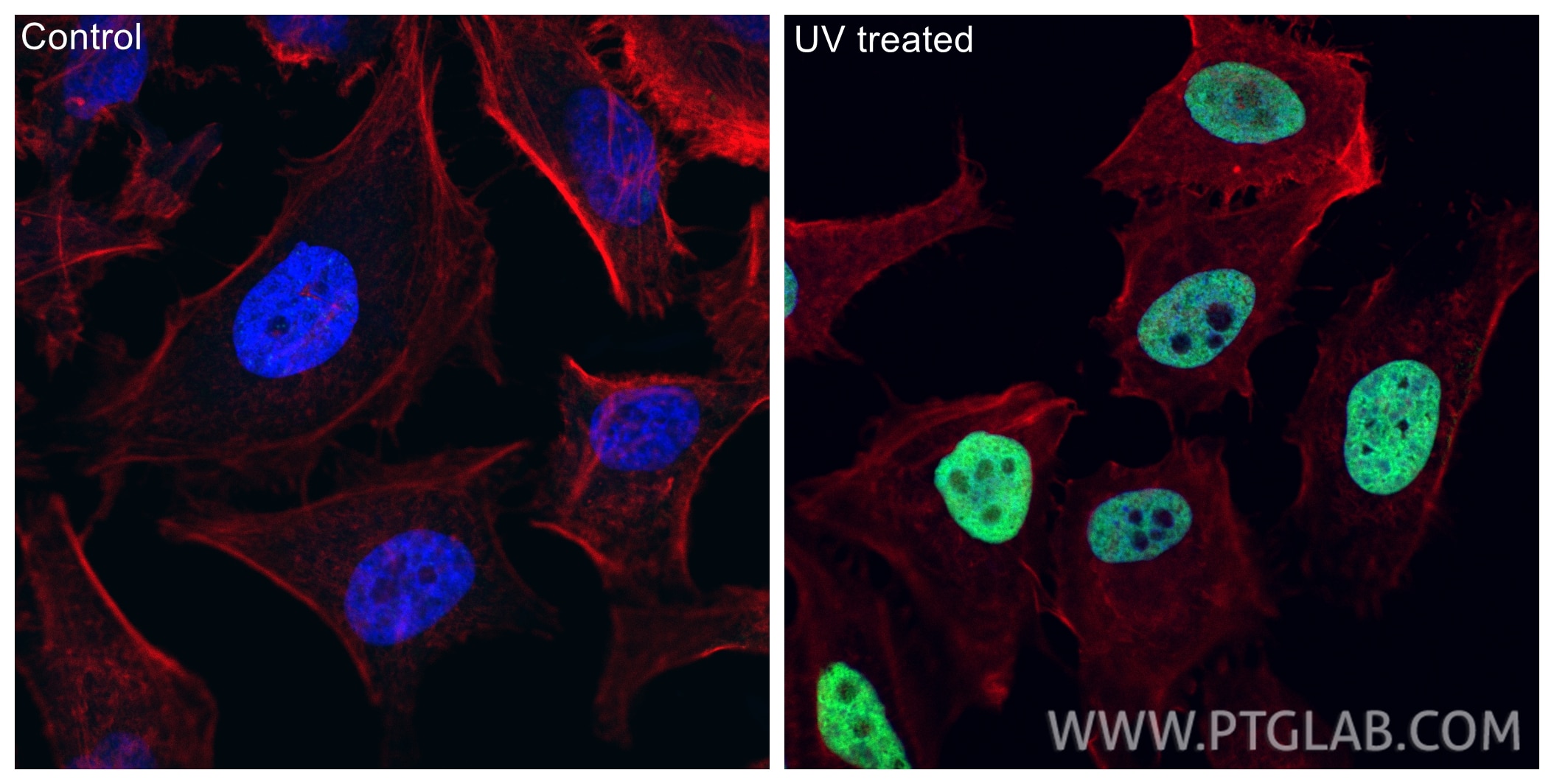 Immunofluorescence (IF) / fluorescent staining of HeLa cells using Phospho-Histone H2A.X (Ser139) Polyclonal antibody (29380-1-AP)