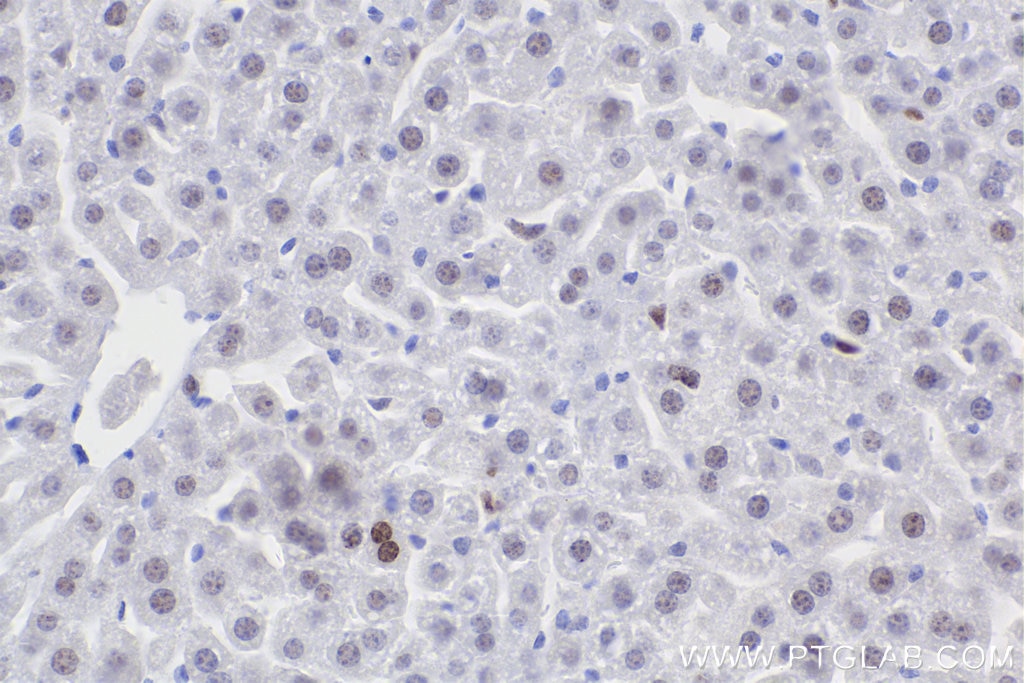 IHC staining of mouse liver using 83307-2-RR Immunohistochemistry (IHC) staining of mouse liver tissue using Phospho-Histone H2A.X (Ser139) Recombinant monoclo (83307-2-RR)