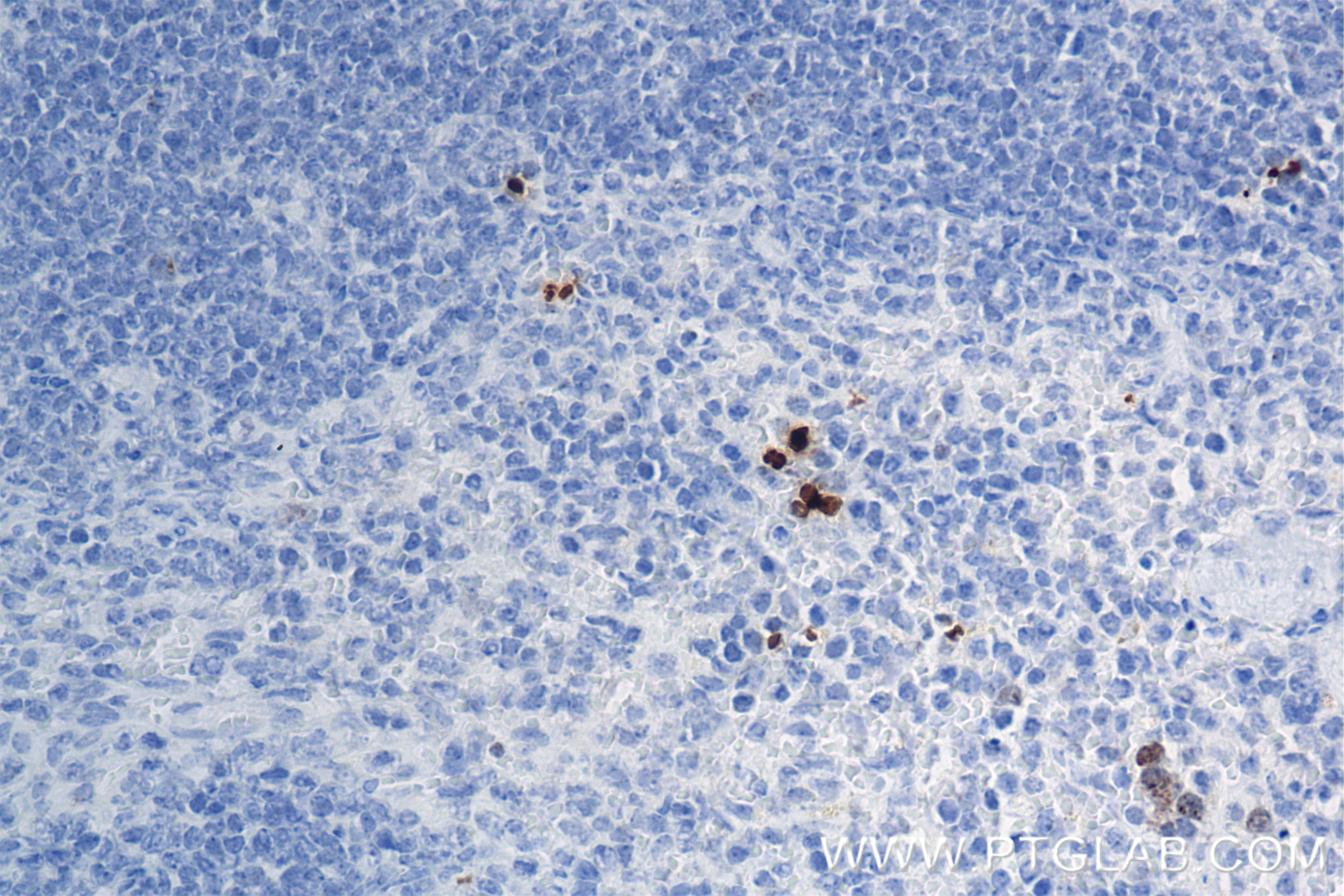 Immunohistochemistry (IHC) staining of mouse spleen tissue using Phospho-Histone H2A.X (Ser139) Recombinant antibod (83307-2-RR)