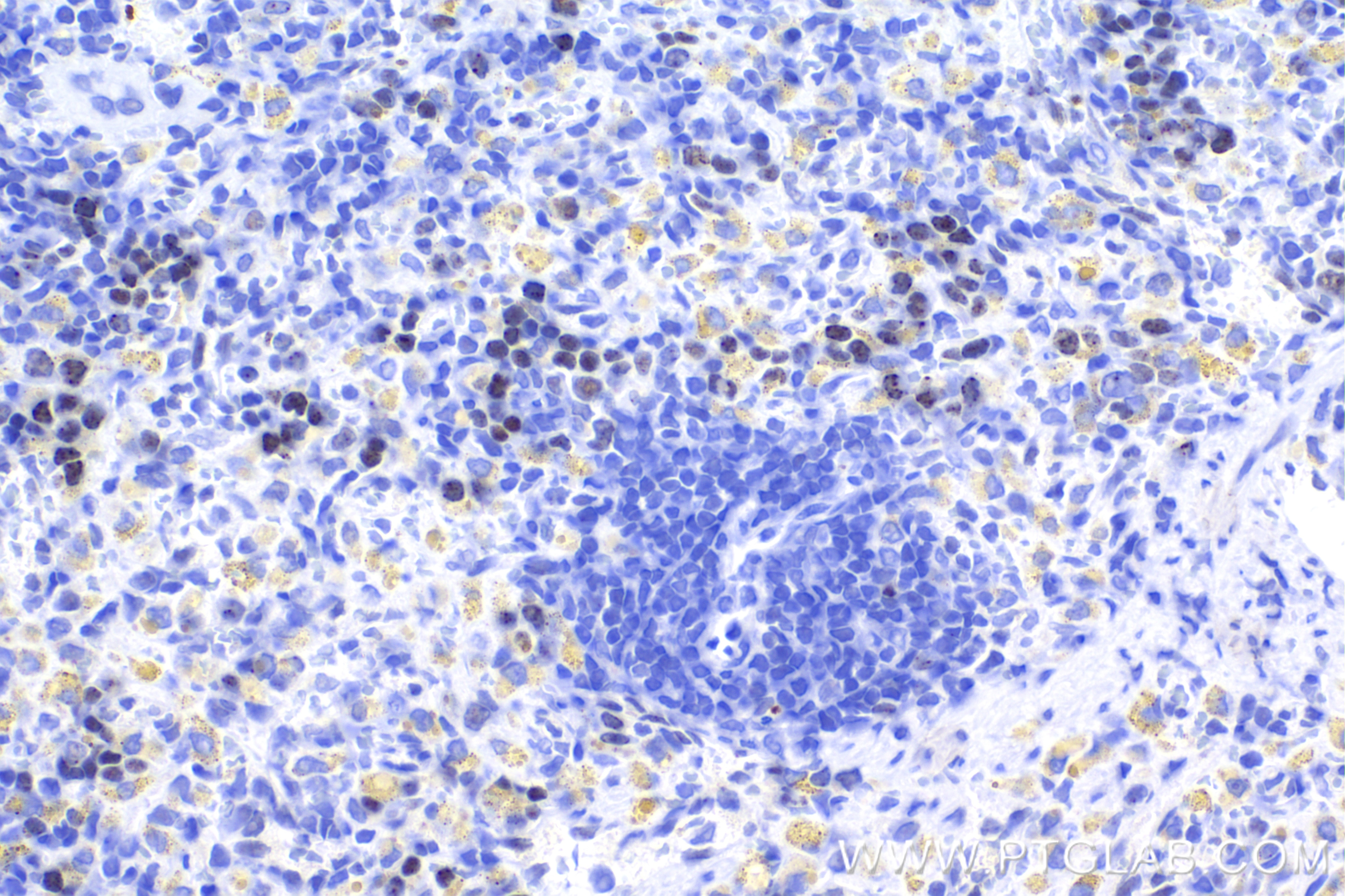 Immunohistochemistry (IHC) staining of rat spleen tissue using Phospho-Histone H2A.X (Ser139) Recombinant antibod (83307-2-RR)