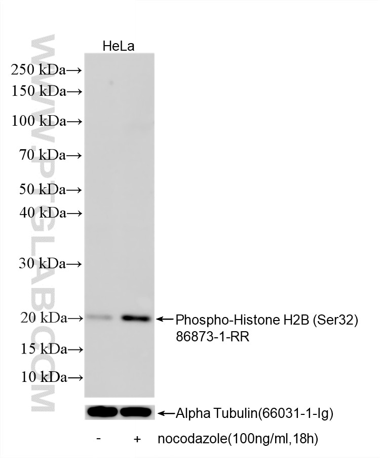Western Blot (WB) analysis of various lysates using Phospho-Histone H2B (Ser32) Recombinant monoclonal (86873-1-RR)