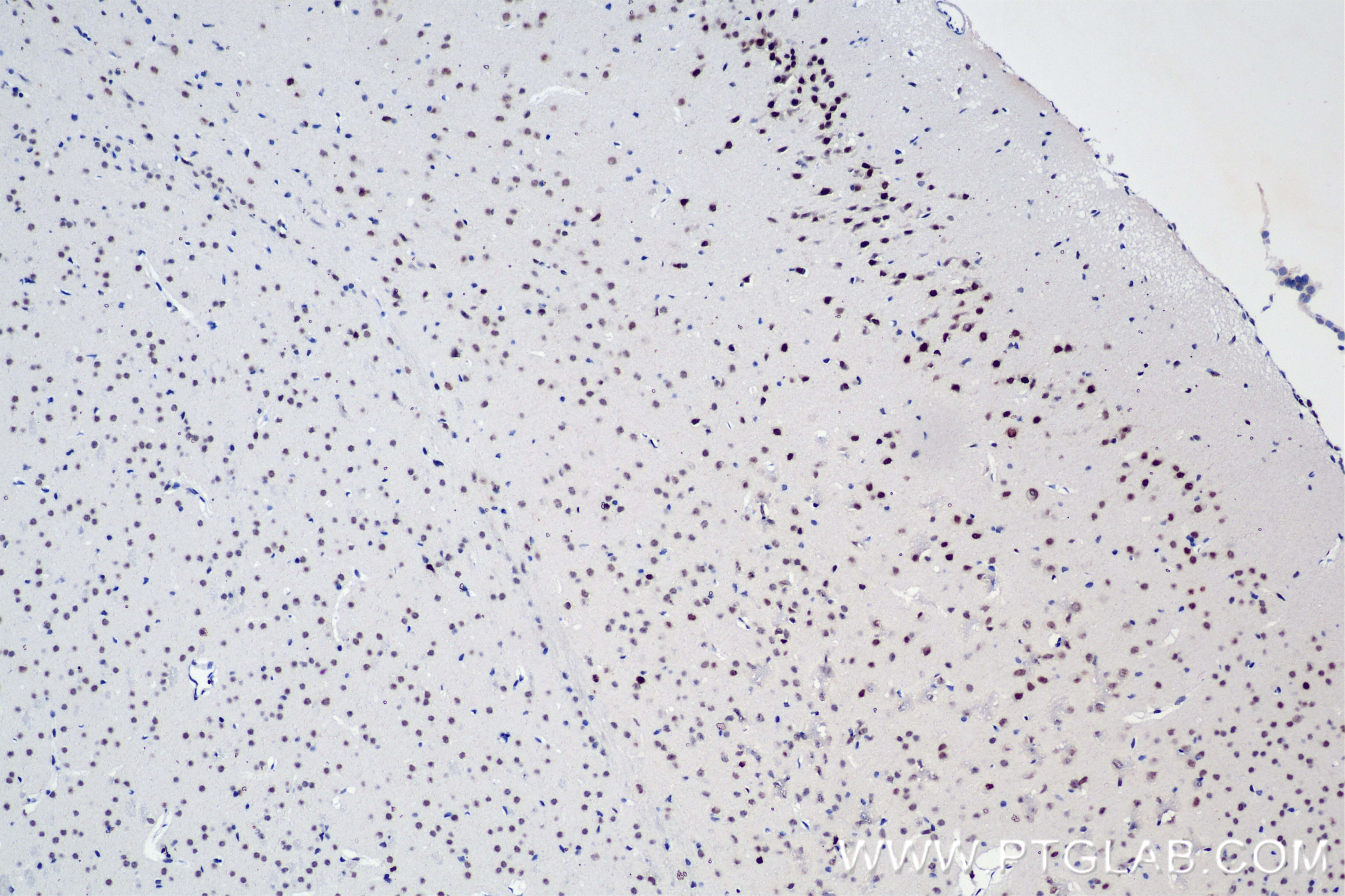 Immunohistochemistry (IHC) staining of mouse brain tissue using Phospho-Histone H3 (Ser10) Recombinant antibody (82828-10-RR)