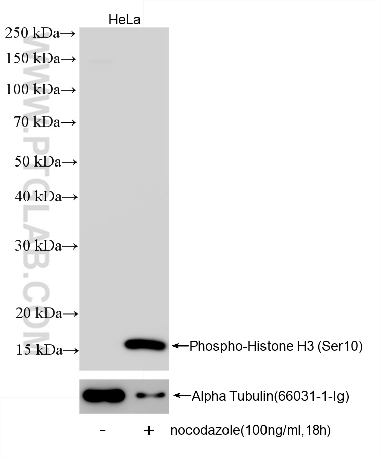 Western Blot (WB) analysis of HeLa cells using Phospho-Histone H3 (Ser10) Recombinant antibody (82828-10-RR)