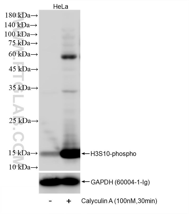 WB analysis of HeLa using 82828-16-RR Western Blot (WB) analysis of HeLa cells using Phospho-Histone H3 (Ser10) Recombinant monoclonal (82828-16-RR)