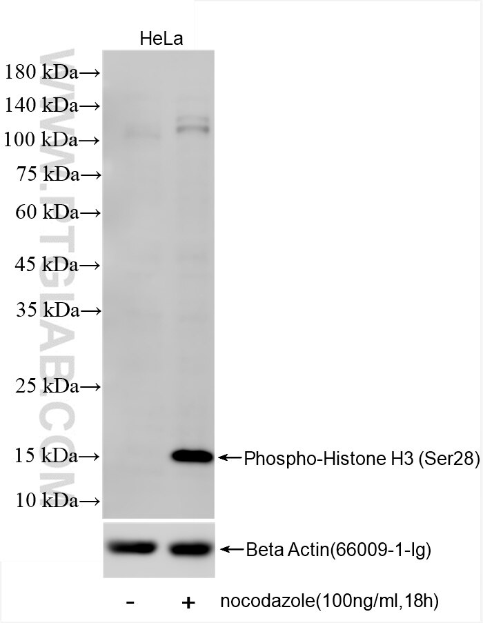 Western Blot (WB) analysis of HeLa cells using Phospho-Histone H3 (Ser28) Recombinant antibody (82828-15-RR)