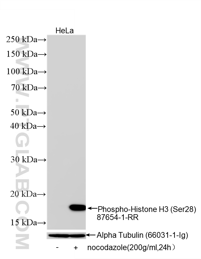 WB analysis using 87654-1-RR Western Blot (WB) analysis of various lysates using Phospho-Histone H3 (Ser28) Recombinant monoclonal (87654-1-RR)