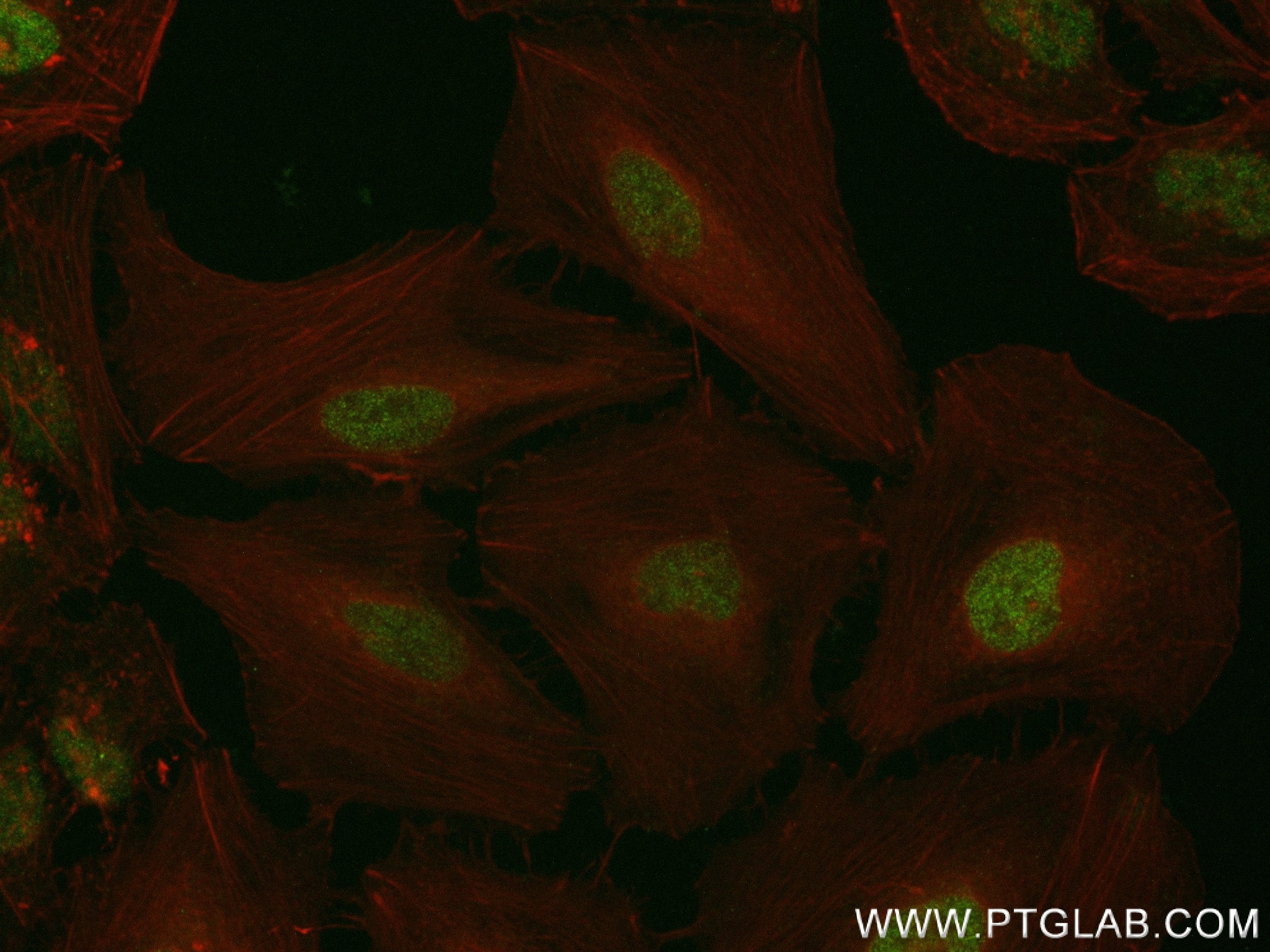 Immunofluorescence (IF) / fluorescent staining of HeLa cells using Phospho-Histone H3 (Thr3) Recombinant antibody (84739-1-RR)