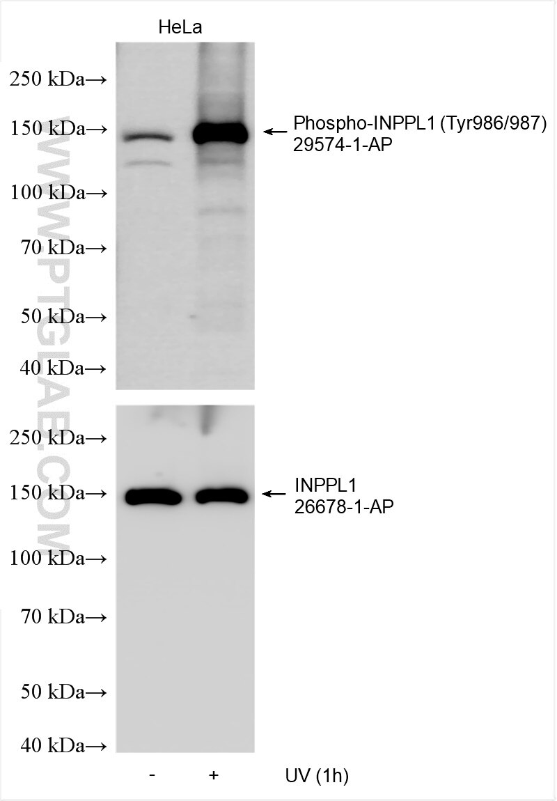 Western Blot (WB) analysis of various lysates using Phospho-INPPL1 (Tyr986/987) Polyclonal antibody (29574-1-AP)