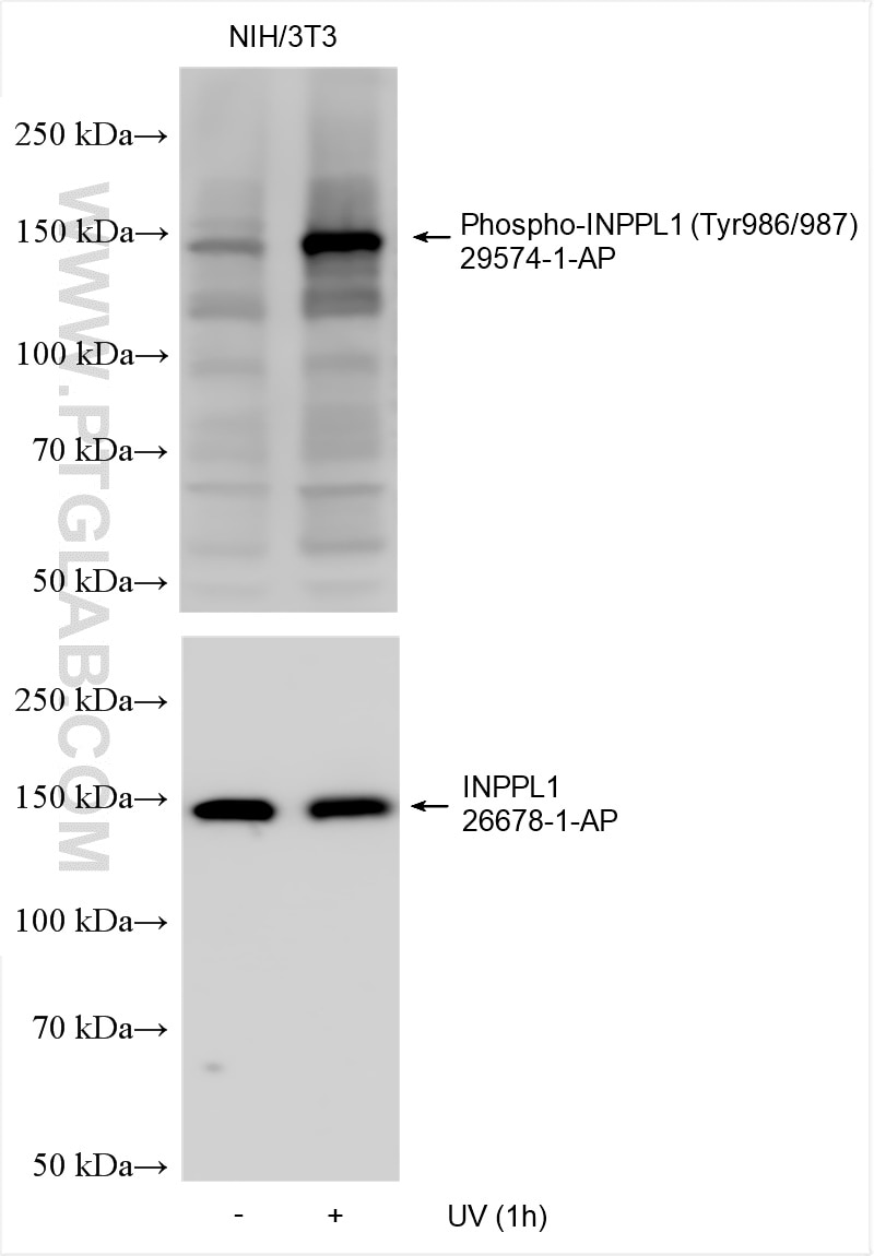 Western Blot (WB) analysis of various lysates using Phospho-INPPL1 (Tyr986/987) Polyclonal antibody (29574-1-AP)