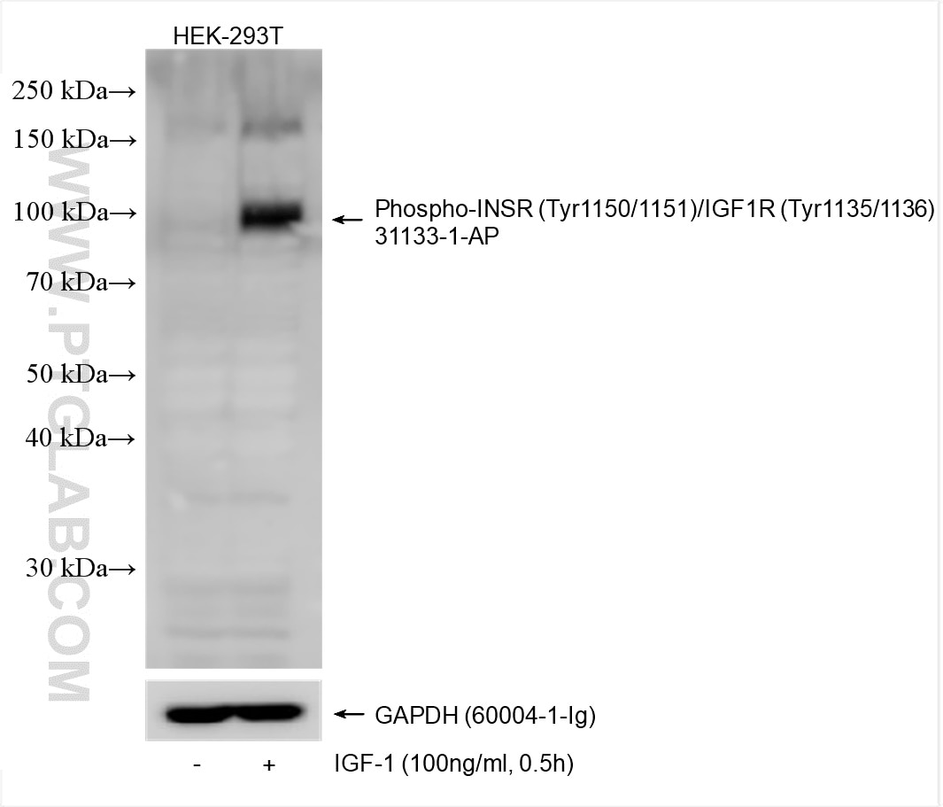 Western Blot (WB) analysis of HEK-293T cells using Phospho-INSR (Tyr1150/1151)/IGF1R (Tyr1135/1136) P (31133-1-AP)