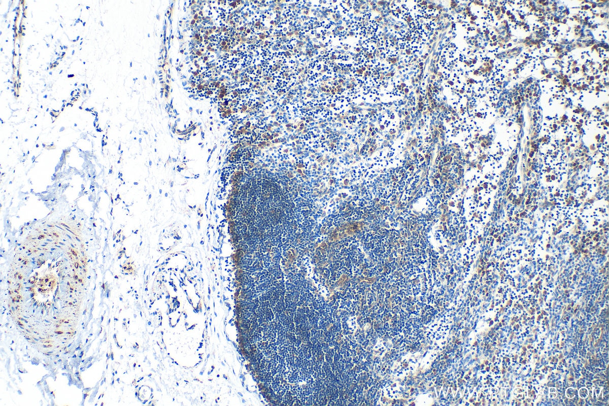 Immunohistochemistry (IHC) staining of rat lymph node tissue using Phospho-IRAK4 (Thr345/Ser346) Recombinant antibody (85753-1-RR)