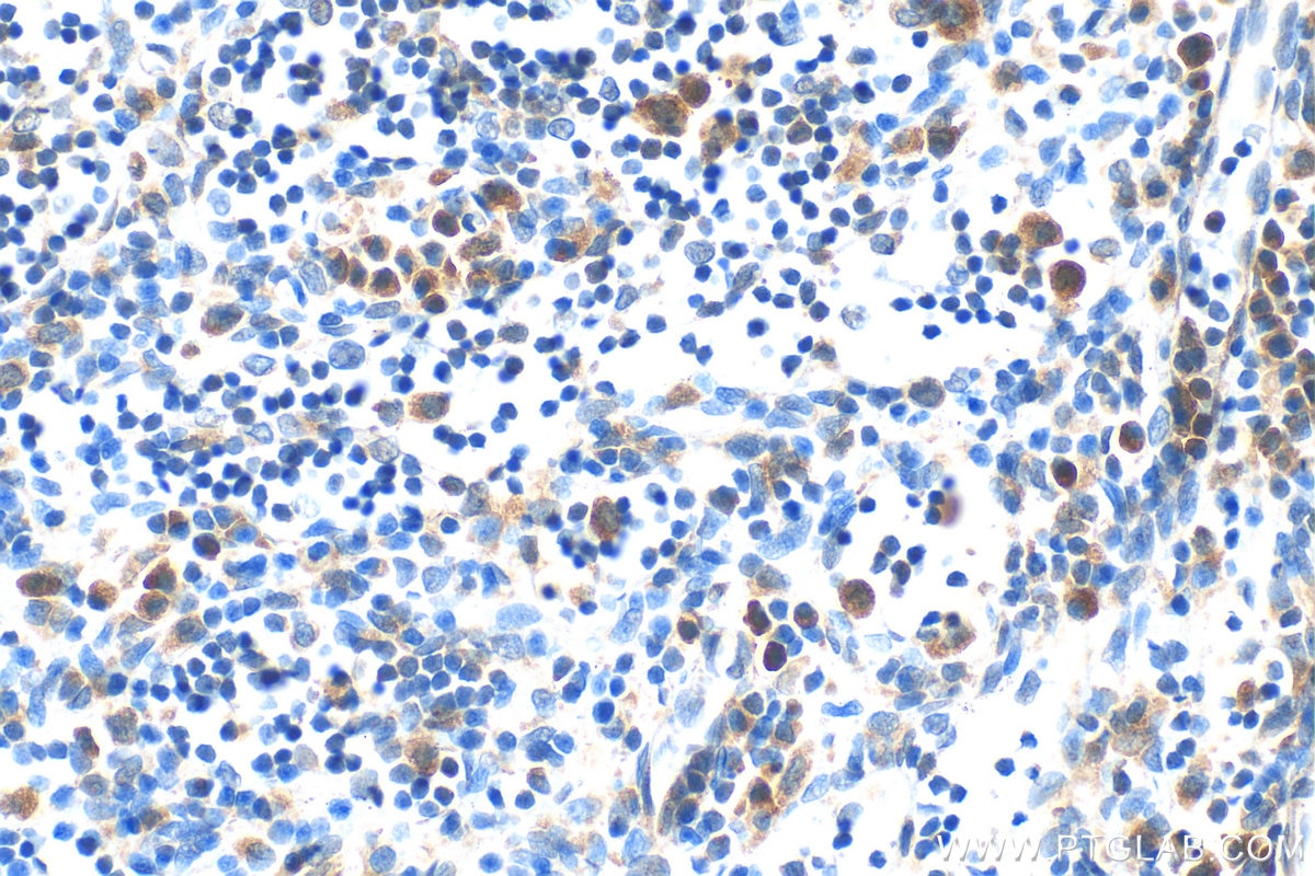 Immunohistochemistry (IHC) staining of rat lymph node tissue using Phospho-IRAK4 (Thr345/Ser346) Recombinant antibody (85753-1-RR)
