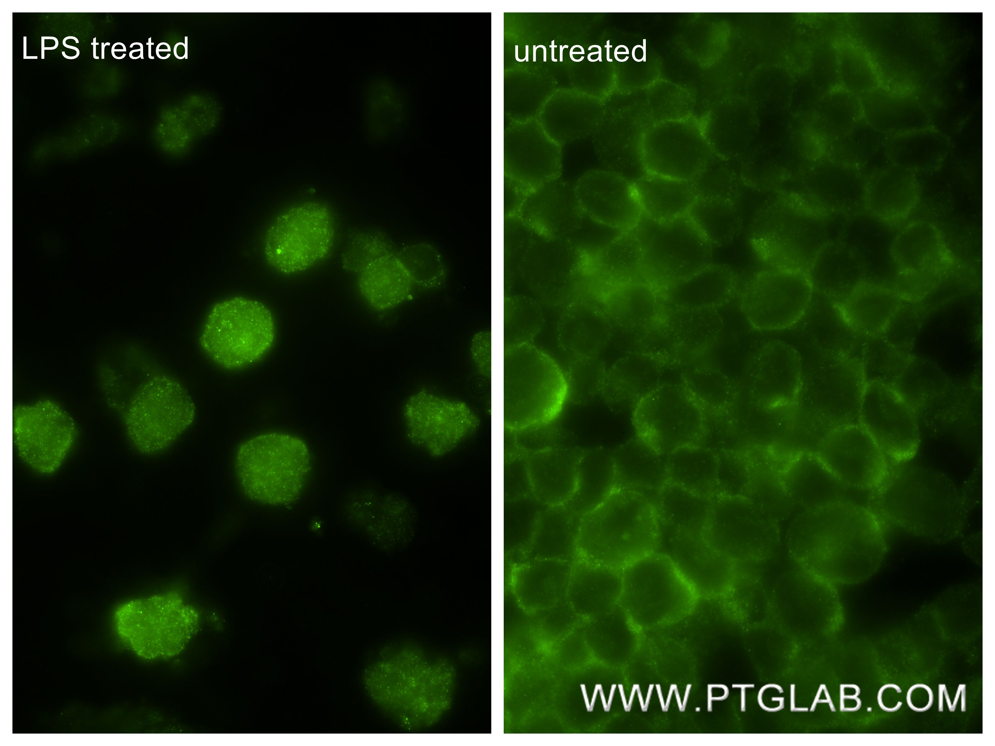 Immunofluorescence (IF) / fluorescent staining of THP-1 cells using Phospho-IRF3 (Ser396) Recombinant monoclonal antib (80519-2-RR)