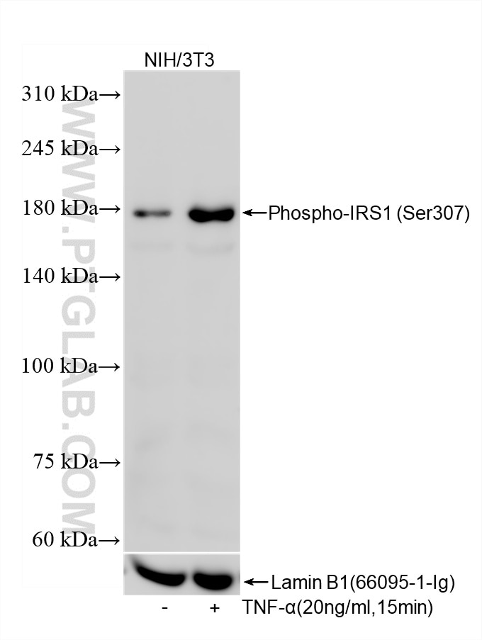 Western Blot (WB) analysis of various lysates using Phospho-IRS1 (Ser307) Recombinant antibody (85238-1-RR)