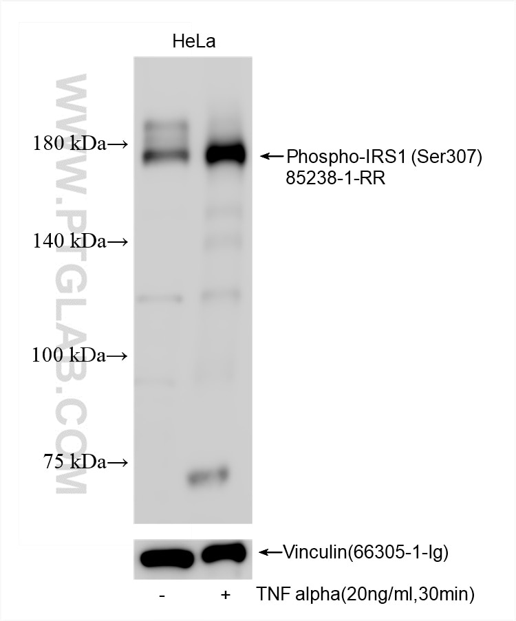 Phospho-IRS1 (Ser307)