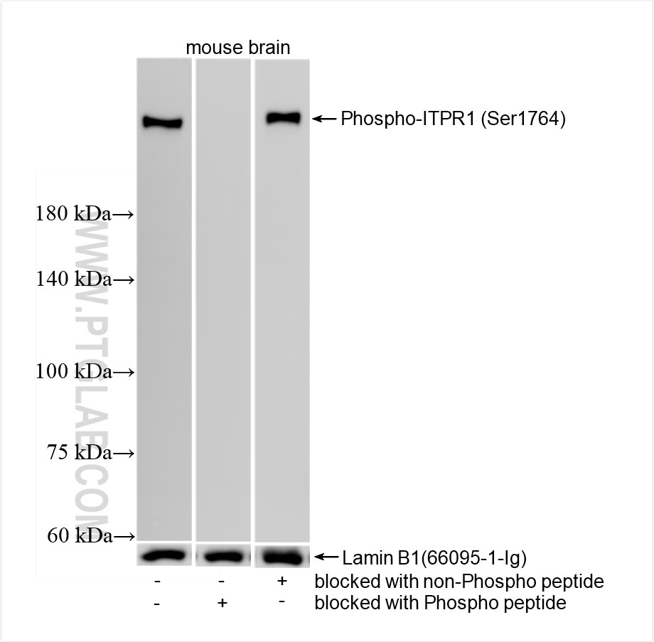 Western Blot (WB) analysis of mouse brain tissue using Phospho-ITPR1 (Ser1764) Recombinant monoclonal ant (87294-1-RR)