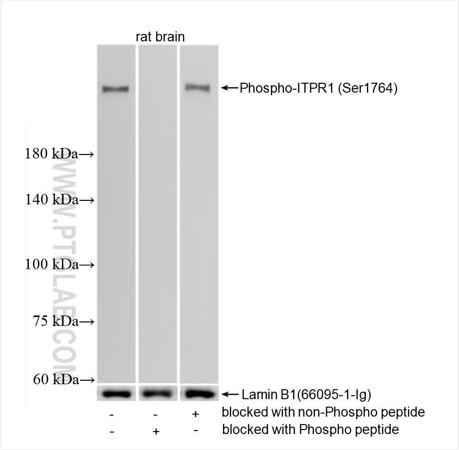 Western Blot (WB) analysis of rat brain tissue using Phospho-ITPR1 (Ser1764) Recombinant monoclonal ant (87294-1-RR)