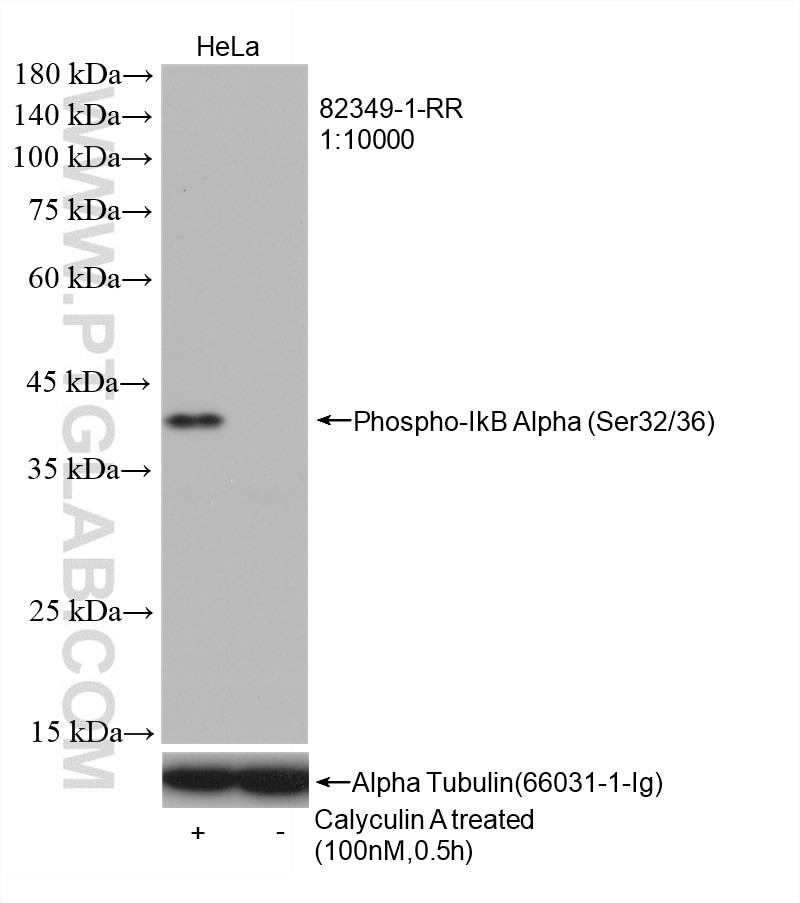 Phospho-IkB Alpha (Ser32/36)