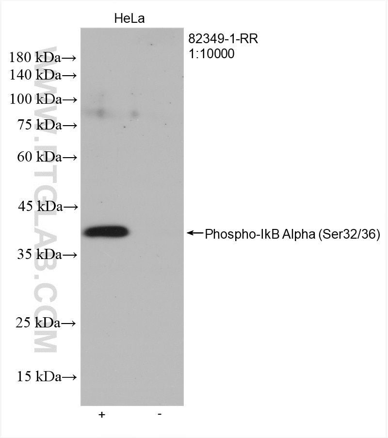 Western Blot (WB) analysis of various lysates using Phospho-IkB Alpha (Ser32/36) Recombinant antibody (82349-1-RR)