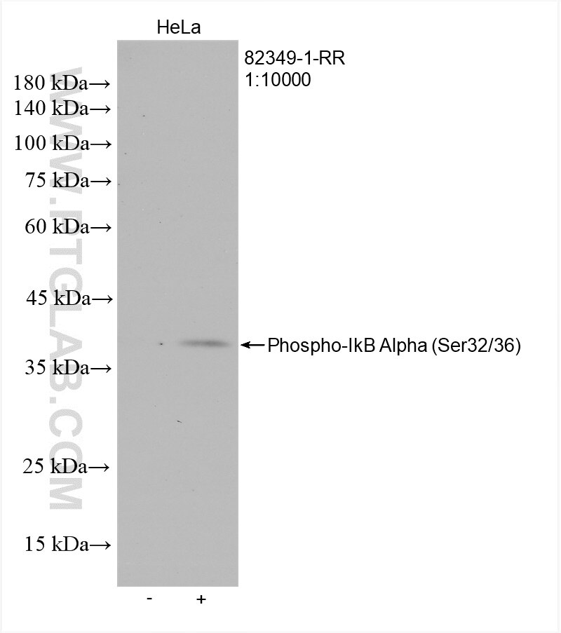 Western Blot (WB) analysis of various lysates using Phospho-IkB Alpha (Ser32/36) Recombinant antibody (82349-1-RR)