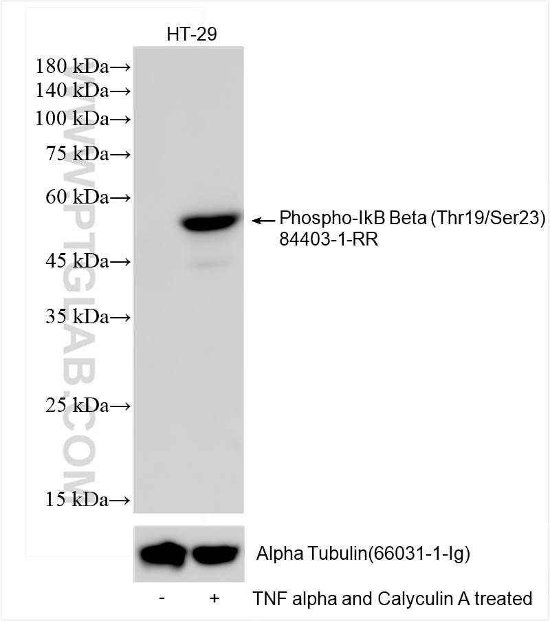 Phospho-IkB Beta (Thr19/Ser23)
